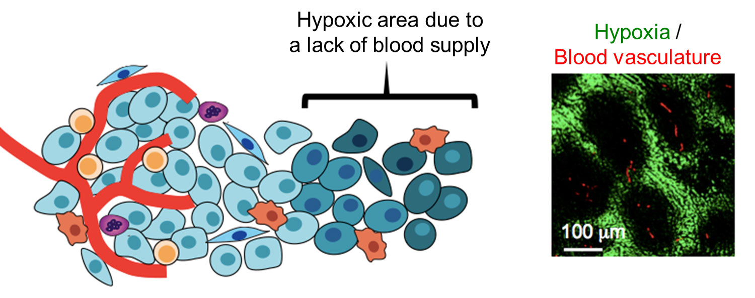 Hypoxic microenvironment in tumor tissues