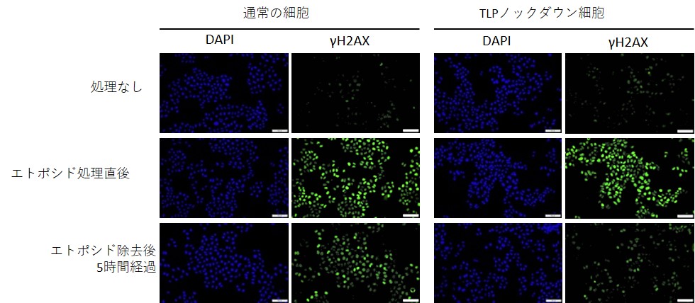 γH2AXを指標にしたDNA二本鎖切断修復速度の解析。TLPノックダウン細胞では通常の細胞よりも速やかにDNA二本鎖切断が修復される。