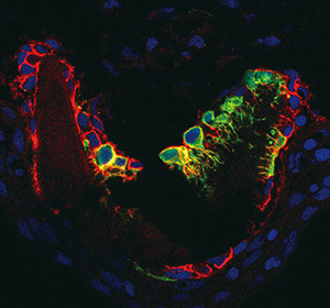 OPC in the niche of fin joint