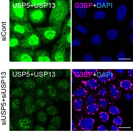 Comparison of cells with and without USP5 and USP13