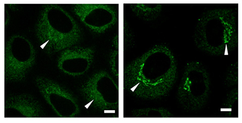 Images of cells with USP8 (left panel) and without USP8 (right panel)
