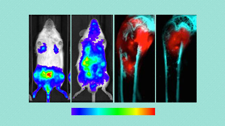 A reliable, easy-to-use mouse model for investigating bone metastasis