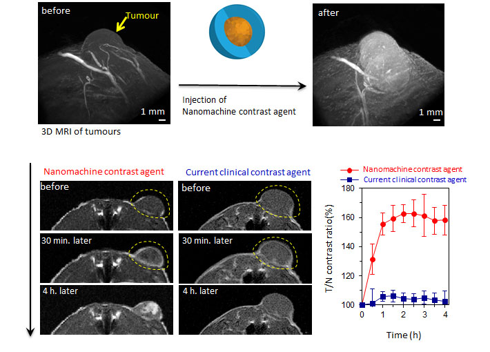 The nanomachine contrast agent makes possible the detection of cancer with a higher contrast than current contrast agents. Further, the regions of higher malignancy inside the tumor mass-produce more intense signals, providing additional information about the structure and the characteristics inside the tumor mass.