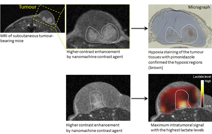 The nanomachine contrast agent may not only detect cancer with an MRI but also be effective in diagnosing its internal structure and malignancy. The nanomachine contrast agent produced stronger signals and made white the regions of low oxygen concentration and low pH levels thought to be especially malignant, even among cancer tissue. This effect was stronger in low-cost MRIs using lower magnetic fields. This means that MRI equipment existing at clinical sites can be used, and this new technology is expected to aid in diagnosing the degree of malignancy of cancers and their resistance to treatment.