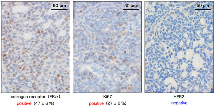 Subtype classification of Nrk  mutant breast tumor