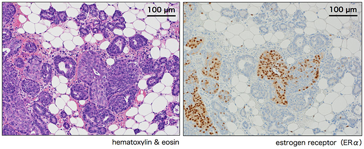 ERα expression of in Nrk mutant mammary epithelial cells