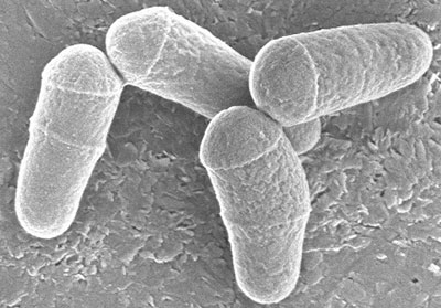 SEM image of Corynebacterium glutamicum