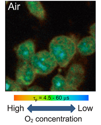 Oxygen concentration imaging inside a single cell by phosphorescence lifetime measurement