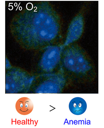 Oxygen concentration imaging inside a single cell by phosphorescence lifetime measurement