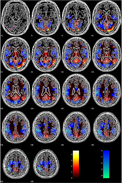 Conceptual Modeling in Neuroimaging