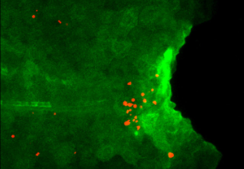 Excess Il1b induces apoptosis of regenerative cells.