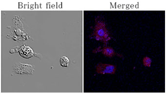 Apoptosis induction of hepatocyte by pathogenic fungi