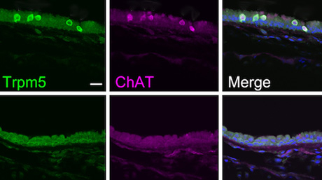 A whole-body approach to understanding chemosensory cells