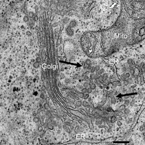 脱ユビキチン化酵素の働きを抑えた細胞の電子顕微鏡像