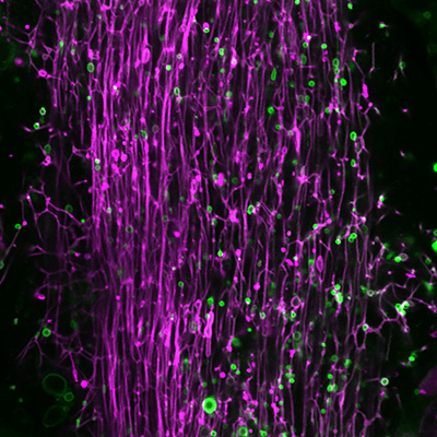 筋細胞内の管状リソソームネットワーク（マゼンタ）と後期エンドソーム（グリーン）