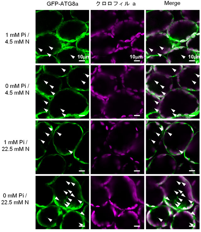 図2. 各栄養条件下のシロイヌナアズナ葉の細胞におけるオートファジックボディー形成の共焦点顕微鏡観察
