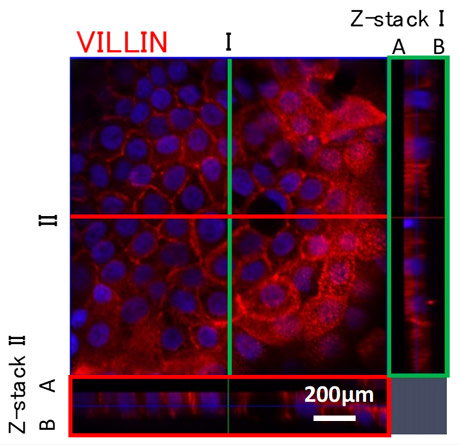 図1. 抗villin抗体で染色したiPS-腸細胞の蛍光顕微鏡観察像。