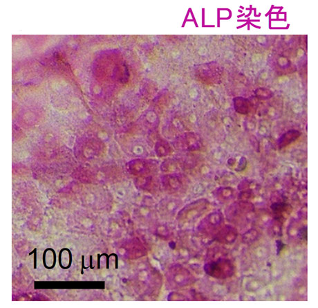 図2. アルカリフォスファターゼ（ALP）染色を行ったiPS-腸細胞の光学顕微鏡観察像。