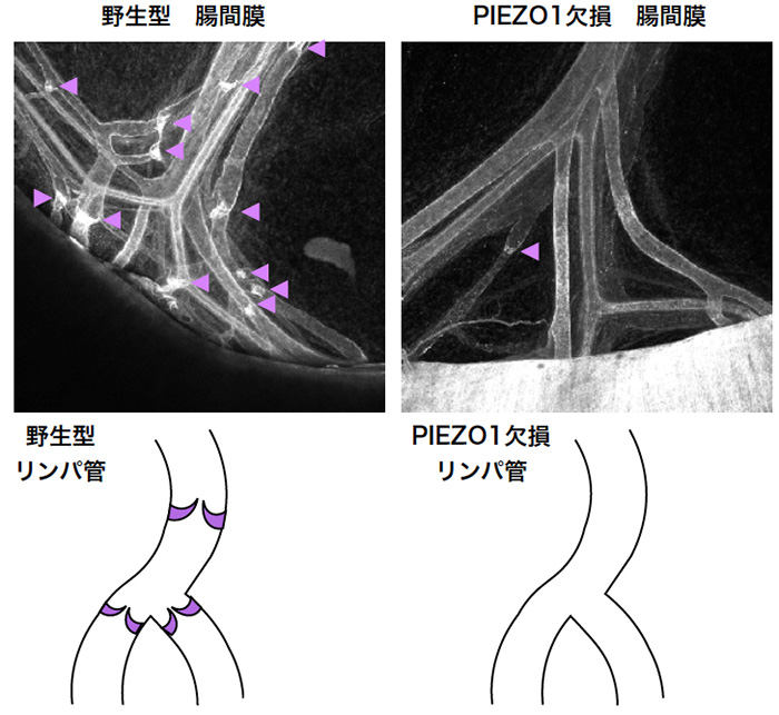 PIEZO1はリンパ管の弁形成に必要である