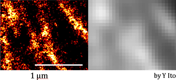 微小管結合タンパク質　（左）超解像画像　（右）従来顕微鏡画像