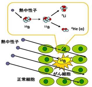 図4 ホウ素中性子捕捉療法の原理
