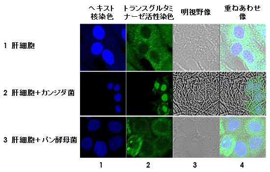 パン酵母との共培養による肝細胞中のトランスグルタミナーゼ（TG2）