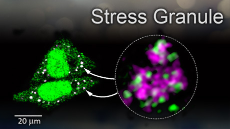 ストレス顆粒の消失促す脱ユビキチン化酵素を発見