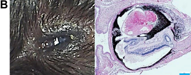 図2. ノックアウトマウス（左：実体顕微鏡像; 右：組織染色像）。
A. 白内障と虹彩異常（矢印）。B. 小眼球。殆どの眼の組織に形成異常が起こっている。