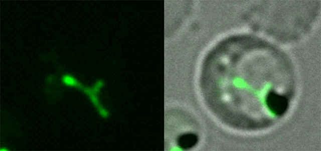 図2. GFP（緑色蛍光タンパク質）を発現させることでアピコプラスト（緑）を可視化した 熱帯熱マラリア原虫の顕微鏡像（画像提供：東京都医学総合研究所・小松谷啓介研究員）