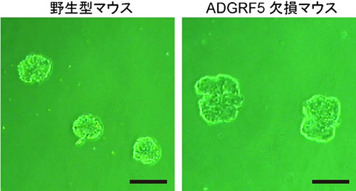 図2 マウスの腎臓から取り出した糸球体の写真 ADGRF5欠損マウスの糸球体（写真右）のサイズは、野生型マウスのもの（写真左）に比べて大きくなっていた。スケールバーはいずれも0.1ミリメートル。