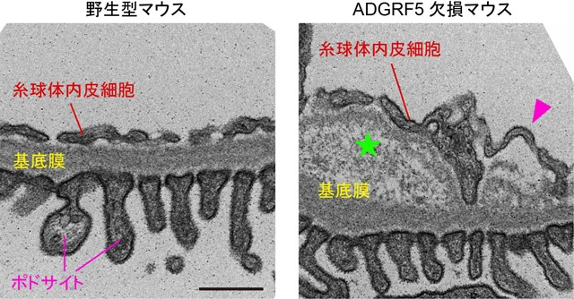 図3 マウスの糸球体ろ過障壁の断面写真 野生型マウス（写真左）とADGRF5欠損マウス（写真右）の糸球体ろ過障壁の断面を透過型電子顕微鏡で撮影した。野生型マウスの場合と比較して、ADGRF5欠損マウスでは糸球体内皮細胞の剥離（矢頭）や基底膜の断裂や肥厚（星印）が生じていて3層構造が壊れている様子が観察された。2枚の写真の拡大倍率は同じ。スケールバーは0.5マイクロメートル（1ミリメートルの2,000分の1）。