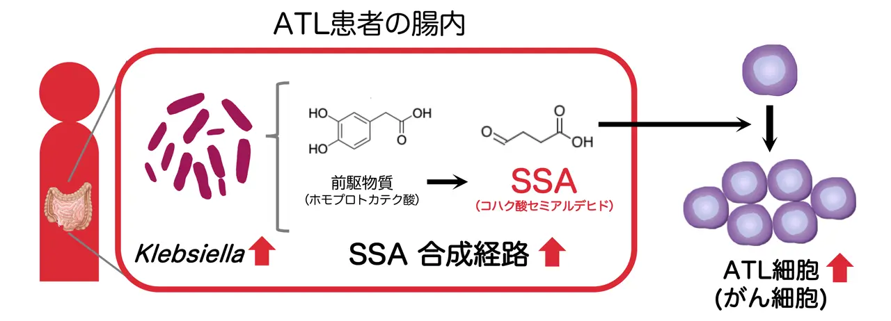 腸内細菌が生産できる代謝物質（SSA）はATL患者のがん細胞の増殖を促進する。