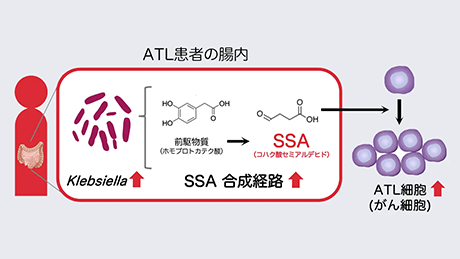 腸内細菌が成人T細胞白血病リンパ腫の進行に与える影響