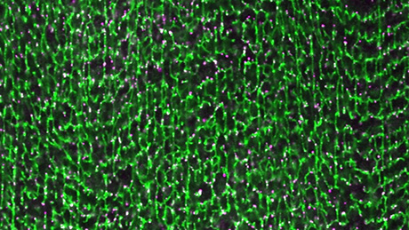 筋収縮に不可欠な“横行小管”をつくる新たな仕組みを解明
