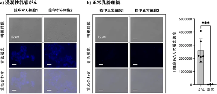 図4. 乳がん患者組織での迅速診断の実証