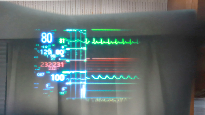 The image seen through AR glasses