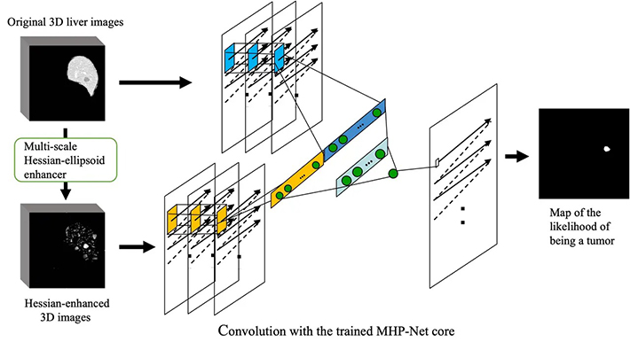 Overview of MHP-Net
