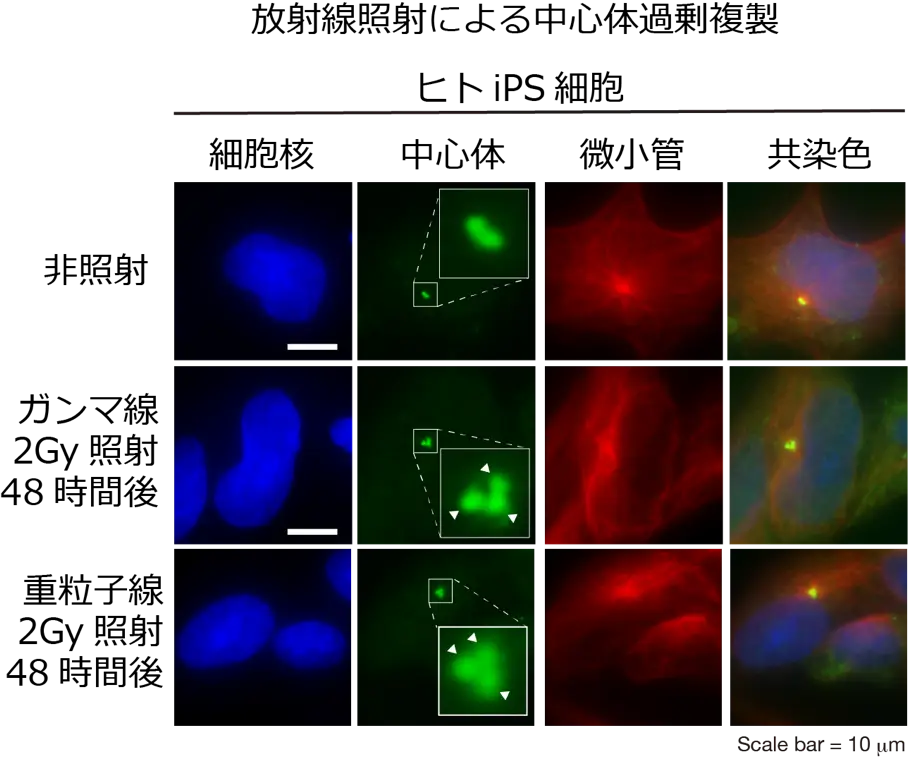 図2. 免疫染色によりヒトiPS細胞の細胞核（DAPI: 青）、中心体（pericentirn: 緑）、微小管（α-tubulin: 赤）を染色した。放射線照射によりヒトiPS細胞において正常な場合は一個ないし二個の中心体の数が増加している。