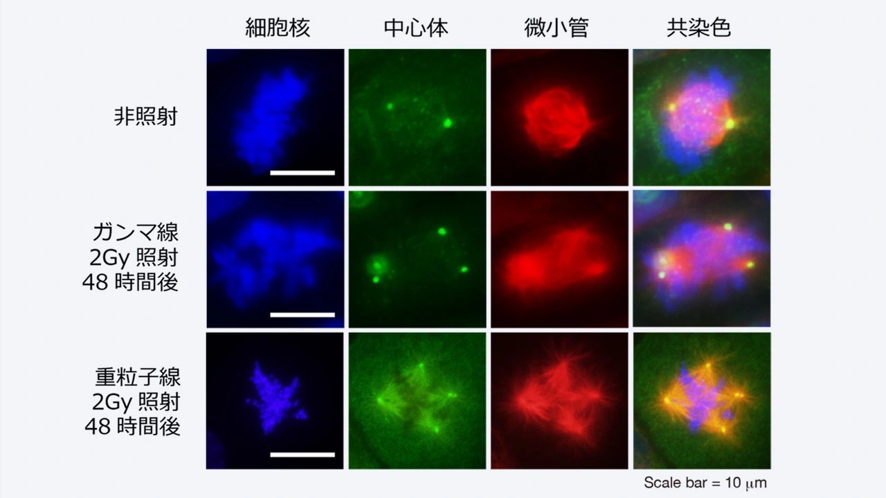 ヒトiPS細胞における重粒子線に対する防護剤の開発